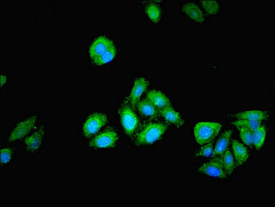 PGM1 Polyclonal Antibody - image 5