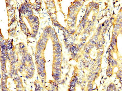 Immunofluorescence staining of Hela cells with CAC13867 at 1:175, counter-stained with DAPI. The cells were fixed in 4% formaldehyde, permeabilized using 0.2% Triton X-100 and blocked in 10% normal Goat Serum. The cells were then incubated with the antibody overnight at 4°C. The secondary antibody was Alexa Fluor 488-congugated AffiniPure Goat Anti-Rabbit IgG(H+L).