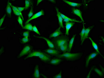 PKM Polyclonal Antibody - image 5