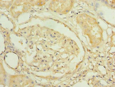 PNRC2 Polyclonal Antibody - image 3