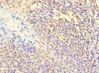 Immunohistochemistry of paraffin-embedded human testis tissue using CAC13873 at dilution of 1:100