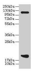 Immunohistochemistry of paraffin-embedded human tonsil tissue using CAC13878 at dilution of 1:100