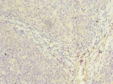 PPIH Polyclonal Antibody - image 3