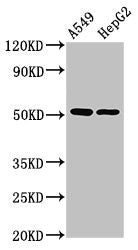 Immunohistochemistry of paraffin-embedded human testis tissue using CAC13879 at dilution of 1:100
