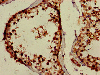Immunofluorescent analysis of PC-3 cells using CAC13879 at dilution of 1:100 and Alexa Fluor 488-congugated AffiniPure Goat Anti-Rabbit IgG(H+L)