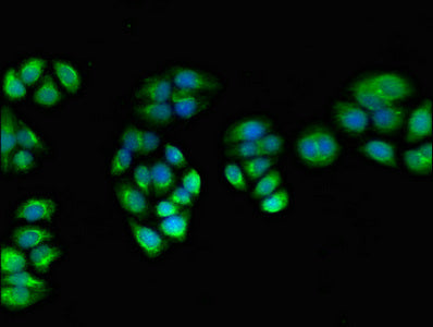 Immunoprecipitating PPOX in HepG2 whole cell lysate, Lane 1: Rabbit control IgG (1ug) instead of CAC13879 in HepG2 whole cell lysate. For western blotting, a HRP-conjugated Protein G antibody was used as the secondary antibody (1/2000), Lane 2: CAC13879 (8ug) + HepG2 whole cell lysate (500ug), Lane 3: HepG2 whole cell lysate (10ug)