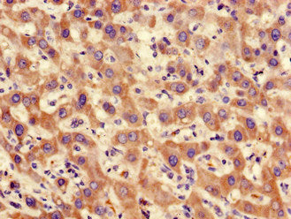 Immunofluorescent analysis of Hela cells using CAC13881 at dilution of 1:100 and Alexa Fluor 488-congugated AffiniPure Goat Anti-Rabbit IgG(H+L)