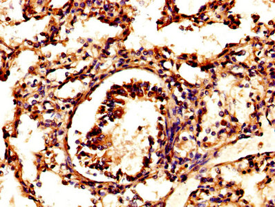 IHC image of CAC13883 diluted at 1:500 and staining in paraffin-embedded human brain tissue performed on a Leica BondTM system. After dewaxing and hydration, antigen retrieval was mediated by high pressure in a citrate buffer (pH 6.0). Section was blocked with 10% normal goat serum 30min at RT. Then primary antibody (1% BSA) was incubated at 4°C overnight. The primary is detected by a biotinylated secondary antibody and visualized using an HRP conjugated SP system.
