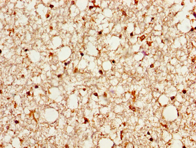 Immunofluorescence staining of MCF-7 cells with CAC13883 at 1:166, counter-stained with DAPI. The cells were fixed in 4% formaldehyde, permeabilized using 0.2% Triton X-100 and blocked in 10% normal Goat Serum. The cells were then incubated with the antibody overnight at 4°C. The secondary antibody was Alexa Fluor 488-congugated AffiniPure Goat Anti-Rabbit IgG(H+L).