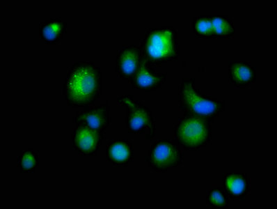 PSAP Polyclonal Antibody - image 5