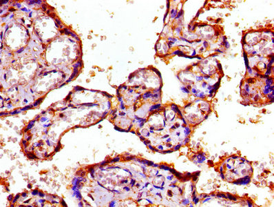 Immunofluorescence staining of MCF-7 cells with CAC13886 at 1:266, counter-stained with DAPI. The cells were fixed in 4% formaldehyde, permeabilized using 0.2% Triton X-100 and blocked in 10% normal Goat Serum. The cells were then incubated with the antibody overnight at 4°C. The secondary antibody was Alexa Fluor 488-congugated AffiniPure Goat Anti-Rabbit IgG(H+L).