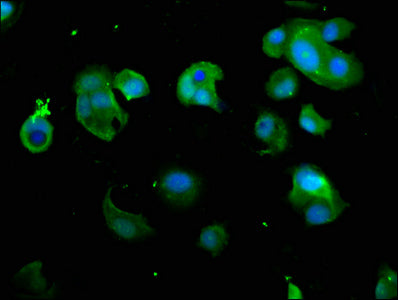 PSMD7 Polyclonal Antibody - image 4