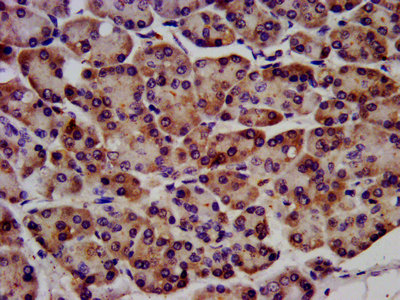 Immunofluorescence staining of Hela cells with CAC13895 at 1:400, counter-stained with DAPI. The cells were fixed in 4% formaldehyde, permeabilized using 0.2% Triton X-100 and blocked in 10% normal Goat Serum. The cells were then incubated with the antibody overnight at 4°C. The secondary antibody was Alexa Fluor 488-congugated AffiniPure Goat Anti-Rabbit IgG(H+L).