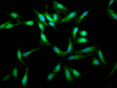 Immunoprecipitating RAF1 in 293T whole cell lysate, Lane 1: Rabbit control IgG (1ug) instead of CAC13895 in 293T whole cell lysate. For western blotting, a HRP-conjugated Protein G antibody was used as the secondary antibody (1/2000), Lane 2: CAC13895 (6ug) + 293T whole cell lysate (500ug), Lane 3: 293T whole cell lysate (10ug)