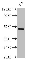 IHC image of CAC13926 diluted at 1:800 and staining in paraffin-embedded human liver tissue performed on a Leica BondTM system. After dewaxing and hydration, antigen retrieval was mediated by high pressure in a citrate buffer (pH 6.0). Section was blocked with 10% normal goat serum 30min at RT. Then primary antibody (1% BSA) was incubated at 4°C overnight. The primary is detected by a biotinylated secondary antibody and visualized using an HRP conjugated SP system.