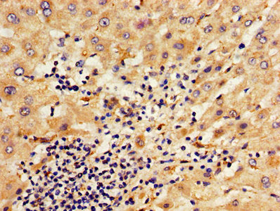 IHC image of CAC13926 diluted at 1:800 and staining in paraffin-embedded human kidney tissue performed on a Leica BondTM system. After dewaxing and hydration, antigen retrieval was mediated by high pressure in a citrate buffer (pH 6.0). Section was blocked with 10% normal goat serum 30min at RT. Then primary antibody (1% BSA) was incubated at 4°C overnight. The primary is detected by a biotinylated secondary antibody and visualized using an HRP conjugated SP system.