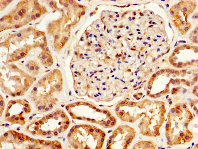 Immunofluorescence staining of HepG2 cells with CAC13926 at 1:266, counter-stained with DAPI. The cells were fixed in 4% formaldehyde, permeabilized using 0.2% Triton X-100 and blocked in 10% normal Goat Serum. The cells were then incubated with the antibody overnight at 4°C. The secondary antibody was Alexa Fluor 488-congugated AffiniPure Goat Anti-Rabbit IgG(H+L).