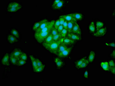 SERPINA6 Polyclonal Antibody - image 5