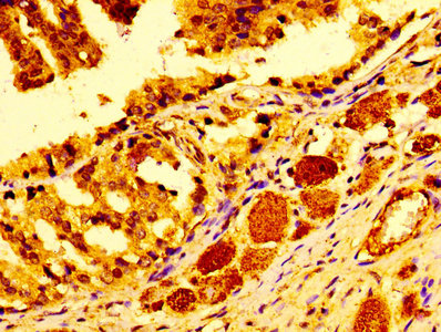 CTSD Polyclonal Antibody - image 4