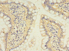 SULT1B1 Polyclonal Antibody - image 3