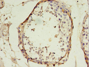 TFAM Polyclonal Antibody - image 3