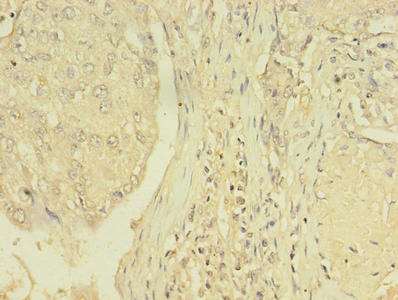 THRB Polyclonal Antibody - image 4