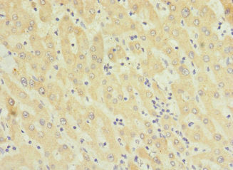Immunohistochemistry of paraffin-embedded human small intestine tissue using CAC13972 at dilution of 1:100