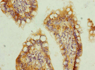 Immunofluorescent analysis of MCF-7 cells using CAC13972 at dilution of 1:100 and Alexa Fluor 488-congugated AffiniPure Goat Anti-Rabbit IgG(H+L)