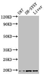 Immunohistochemistry of paraffin-embedded human prostate tissue using CAC13985 at dilution of 1:100