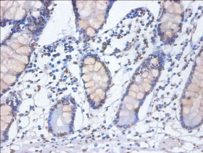 Immunohistochemistry of paraffin-embedded human prostate tissue using CAC13988 at dilution of 1:100