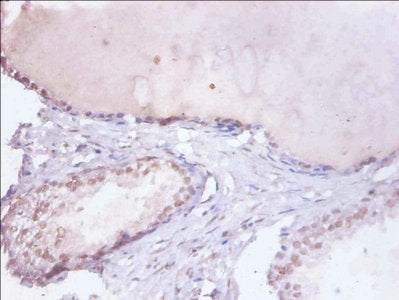 HNRNPD Polyclonal Antibody - image 4
