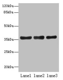 UPP2 Polyclonal Antibody - image 2