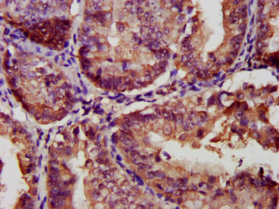 IHC image of CAC14004 diluted at 1:300 and staining in paraffin-embedded human small intestine tissue performed on a Leica BondTM system. After dewaxing and hydration, antigen retrieval was mediated by high pressure in a citrate buffer (pH 6.0). Section was blocked with 10% normal goat serum 30min at RT. Then primary antibody (1% BSA) was incubated at 4°C overnight. The primary is detected by a biotinylated secondary antibody and visualized using an HRP conjugated SP system.