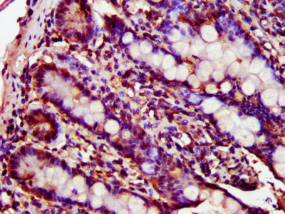 Immunofluorescence staining of NIH/3T3 cells with CAC14004 at 1:100, counter-stained with DAPI. The cells were fixed in 4% formaldehyde, permeabilized using 0.2% Triton X-100 and blocked in 10% normal Goat Serum. The cells were then incubated with the antibody overnight at 4°C. The secondary antibody was Alexa Fluor 488-congugated AffiniPure Goat Anti-Rabbit IgG(H+L).