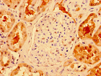IHC image of CAC14030 diluted at 1:300 and staining in paraffin-embedded human testis tissue performed on a Leica BondTM system. After dewaxing and hydration, antigen retrieval was mediated by high pressure in a citrate buffer (pH 6.0). Section was blocked with 10% normal goat serum 30min at RT. Then primary antibody (1% BSA) was incubated at 4°C overnight. The primary is detected by a biotinylated secondary antibody and visualized using an HRP conjugated SP system.