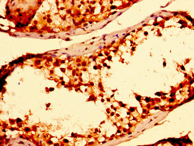 Immunofluorescence staining of Hela cells with CAC14030 at 1:100, counter-stained with DAPI. The cells were fixed in 4% formaldehyde, permeabilized using 0.2% Triton X-100 and blocked in 10% normal Goat Serum. The cells were then incubated with the antibody overnight at 4°C. The secondary antibody was Alexa Fluor 488-congugated AffiniPure Goat Anti-Rabbit IgG(H+L).