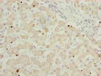 Immunofluorescent analysis of MCF-7 cells using CAC14033 at dilution of 1:100 and Alexa Fluor 488-congugated AffiniPure Goat Anti-Rabbit IgG(H+L)