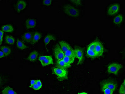 GOT2 Polyclonal Antibody - image 4