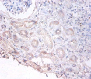 Immunofluorescent analysis of MCF-7 cells using CAC14035 at dilution of 1:100 and Alexa Fluor 488-congugated AffiniPure Goat Anti-Rabbit IgG(H+L)