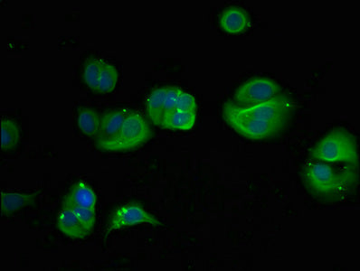 Immunofluorescent analysis of PC-3 cells using CAC14035 at dilution of 1:100 and Alexa Fluor 488-congugated AffiniPure Goat Anti-Rabbit IgG(H+L)