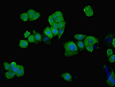 PHGDH Polyclonal Antibody - image 5