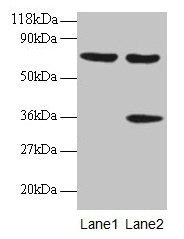 Immunohistochemistry of paraffin-embedded human prostate tissue using CAC14037 at dilution of 1:100