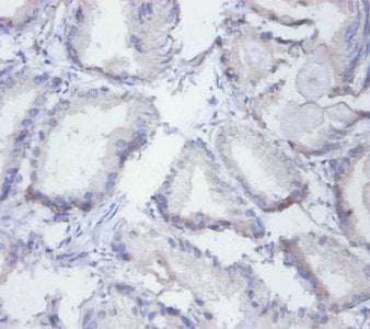 Immunohistochemistry of paraffin-embedded human placenta tissue using CAC14037 at dilution of 1:100