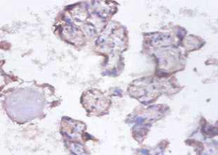 SYNCRIP Polyclonal Antibody - image 4