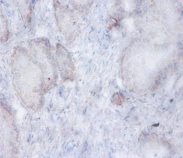 AFG3L2 Polyclonal Antibody - image 3