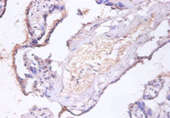 CHMP2A Polyclonal Antibody - image 3