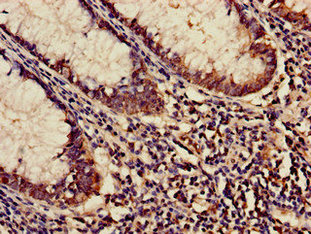 Immunofluorescent analysis of Hela cells using CAC14066 at dilution of 1:100 and Alexa Fluor 488-congugated AffiniPure Goat Anti-Rabbit IgG(H+L)
