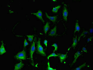 KARS Polyclonal Antibody - image 4
