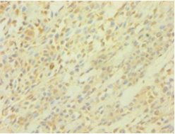 Immunohistochemistry of paraffin-embedded human colon tissue using CAC14078 at dilution of 1:100
