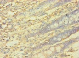 PICK1 Polyclonal Antibody - image 4